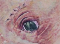 Sutures